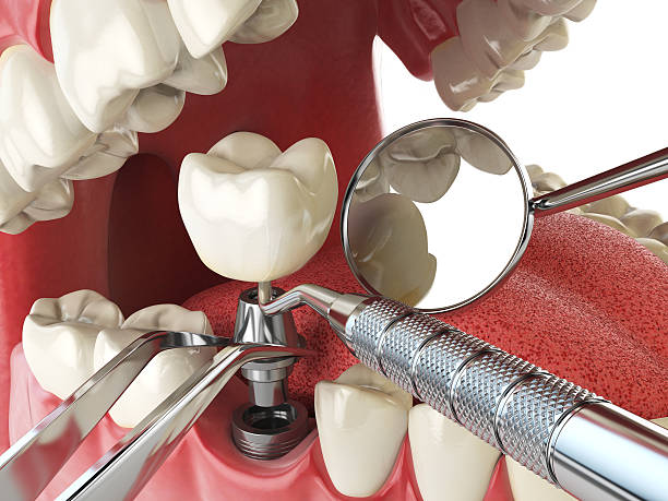 Best Emergency Gum Treatment in Colton, CA